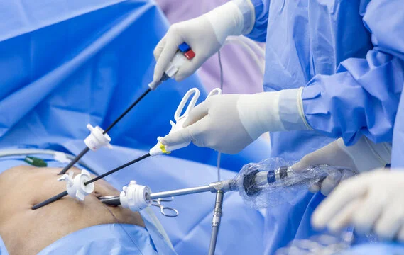 Laparoscopic Surgery